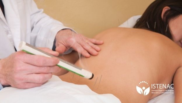 conoce-los-tipos-de-moxa-y-sus-usos-en-tecnicas-acupunturales-UM