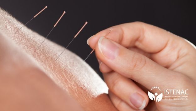 como-aliviar-el-dolor-en-el-sistema-musculoesqueletico-UM