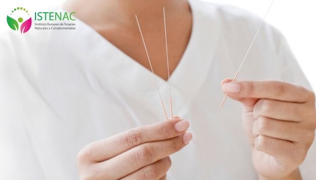 conoce-los-puntos-de-acupuntura-para-activar-la-energia-UM